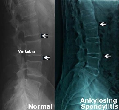 Spine x-ray